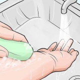 Tratamento de picadas de mosquito