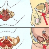 Faça exercícios para os músculos do assoalho pélvico
