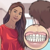Falar com aparelho na boca