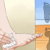 Resolvendo problemas com pés chatos