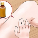 Tratamento da micose: pode naturalmente?
