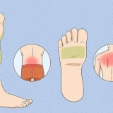 Tratando a dor nas costas com reflexologia