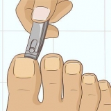Esconder unhas fúngicas