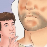 Tratamento do eczema seborreico no rosto