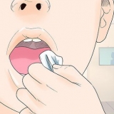 Dormir após a remoção do dente do siso