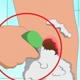 Livre-se das crostas de acne rapidamente