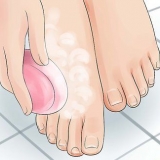 Prevenção de pés fedorentos