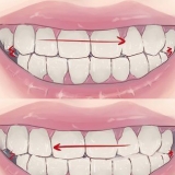 Pare de ranger os dentes enquanto dorme