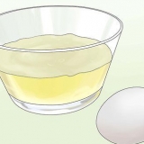 Trate as estrias de forma natural