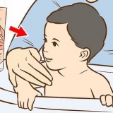 Tratando uma erupção cutânea no pescoço do seu bebê