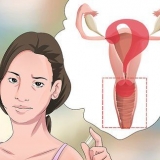 Diagnóstico de corrimento vaginal