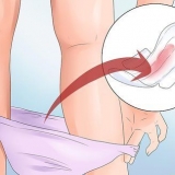 Prevenção de sangramento vaginal durante a gravidez