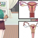 Tratamento de cistos vaginais