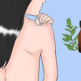 Livre-se da acne em seu corpo