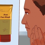 Livre-se de uma espinha com gel de aloe vera