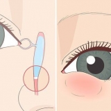 Como se livrar de um ducto lacrimal entupido
