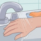 Tratamento de picadas de pulgas
