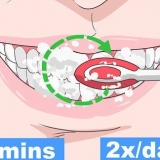 Evitando que uma cárie em seus dentes piore