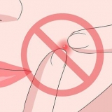 Evitando o desenvolvimento de uma espinha