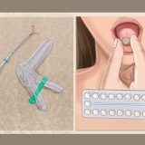 Saiba por que você não menstrua mais