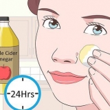 Remover verrugas no rosto