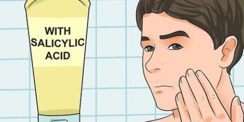 Tratamento da acne (para meninos adolescentes)