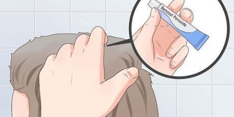 Trate a acne no couro cabeludo