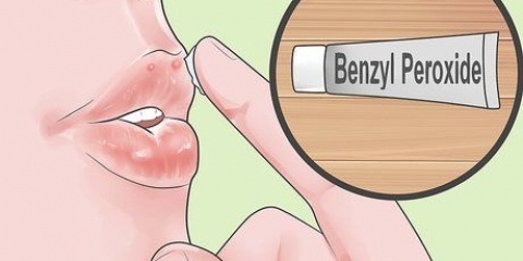 Trate rapidamente a acne ao redor dos lábios