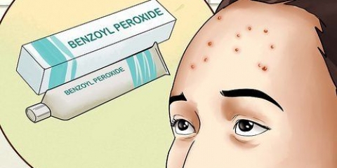 Livre-se da acne na testa
