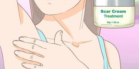 Como se livrar de feridas causadas por furúnculos