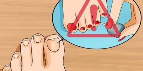 Livre-se das unhas amarelas
