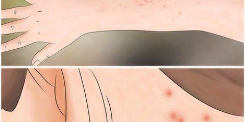 Combate aos percevejos de cama