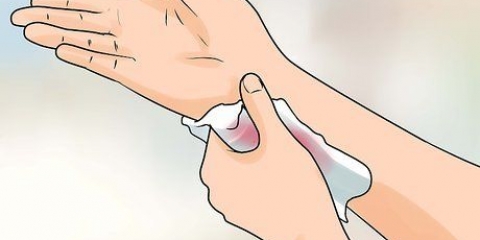 Determinando se uma ferida deve ser suturada