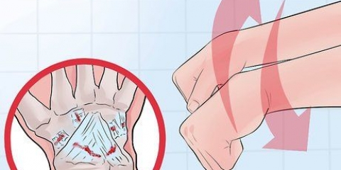 Determine se seu pulso está torcido ou quebrado