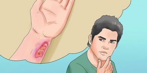 Prevenir o botulismo