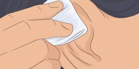 Cure inchaços na cartilagem ao redor do seu piercing