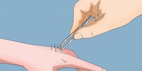 Remover agulhas de cacto