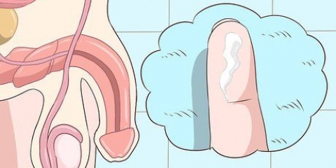Reconhecendo os sintomas da clamídia (para homens)