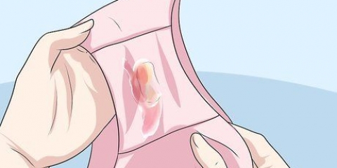 Reconhecendo os sintomas da clamídia (para mulheres)