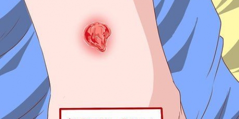 Reconhecendo os sintomas de uma infecção por mrsa