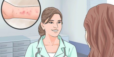 Aliviando os sintomas da dermatite espongiótica