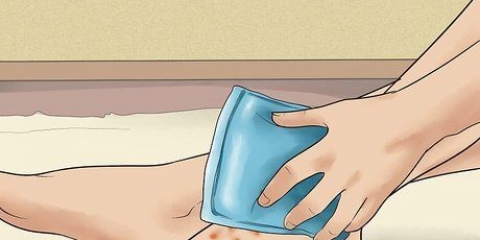 Tratamento do eczema disidrótico