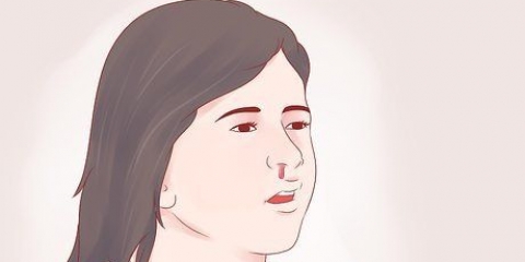 Como curar uma hemorragia nasal em uma criança