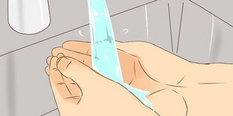 Tratando uma bolha de queimadura