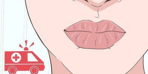 Cure uma queimadura em seus lábios