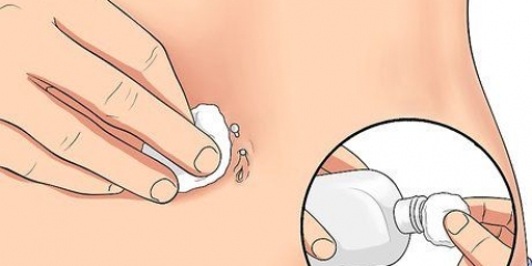 Tratando um piercing no umbigo irritado