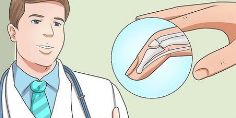 Tratando um dedo em martelo com uma tala
