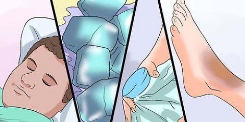 Curando um hematoma