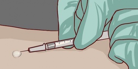 Lendo um teste cutâneo para tuberculose