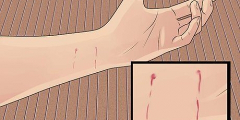 Tratando uma mordida de gato